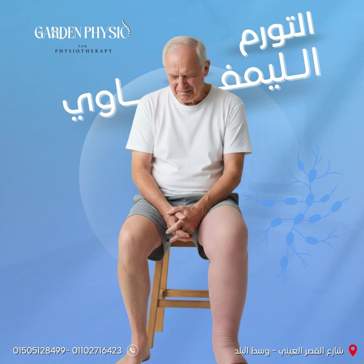 علاج التورم الليمفاوي بالعلاج الطبيعي وتقنية CDT